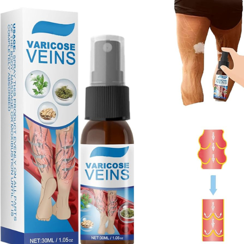 Sumifun Varicose Veins: Fini les problèmes de varices